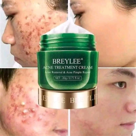 breylee-acne-treatment-serum-big-1